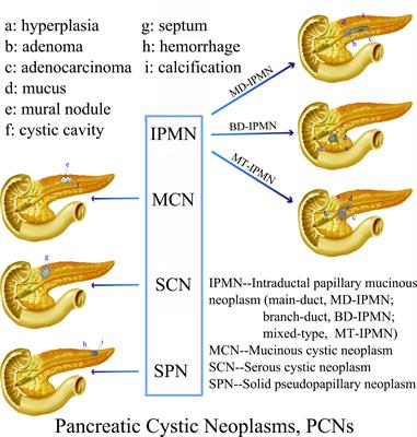 Cystic Neoplasms of the Pancreas: Differential Diagnosis and Radiology Correlation